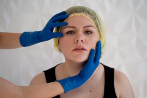 Blefaroplastia preço