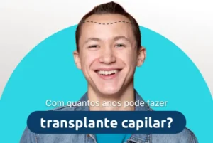 com quantos anos pode fazer transplante capilar?