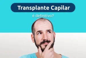 transplante capilar é definitivo