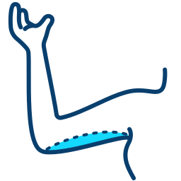 brachioplasty brachioplasty